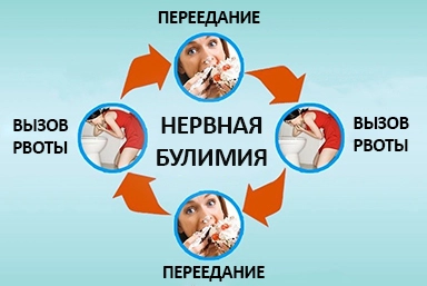 Лечение булимии в Ногликах